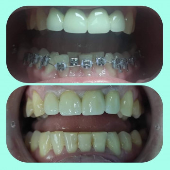 Dental Way сімейна стоматологія, Рівне Фото - 19