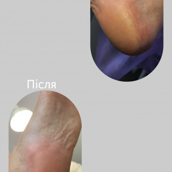 Педикюр (зняття+чистка+покриття гель-лаком)
                    Майстер манікюру Надія Львів