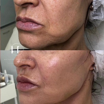 Наталія Рибчинська, Київ Фото - 35