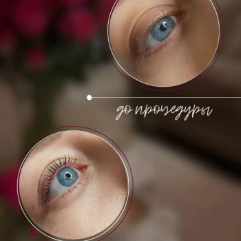 Наташа Фещук, Рівне Фото - 83