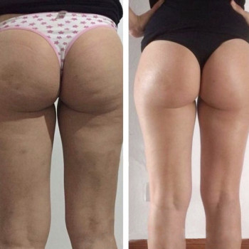 Doskonala, Ужгород Фото - 6