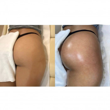 Doskonala, Ужгород Фото - 7