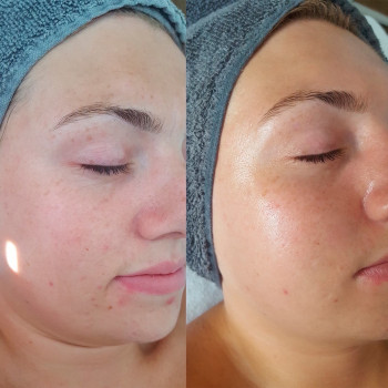 Doskonala, Ужгород Фото - 10