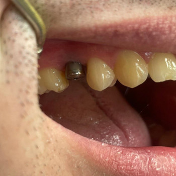 ДентЛюкс, Кременчук Фото - 5