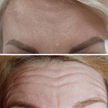 Оксана Захарова, Сумы Фото - 12