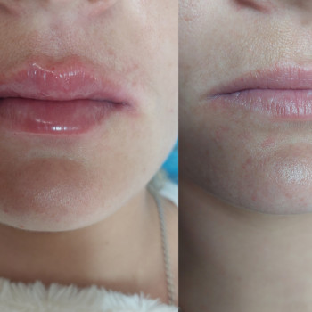 Оксана Захарова, Сумы Фото - 14