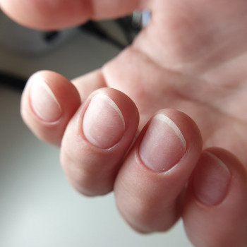 Фото из портфолио специалиста Тетяна Токар (подолог, Ровно)