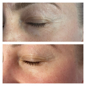 Божена Дорощук, Ровно Фото - 8