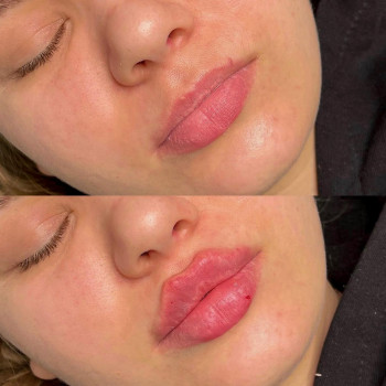 Нонна Корнева, Верхнеднепровск Фото - 6