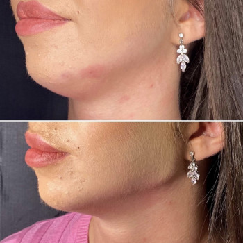 Нонна Корнева, Верхнеднепровск Фото - 9