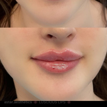 Нонна Корнева, Верхнеднепровск Фото - 18