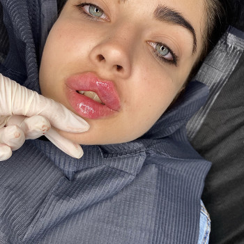 Нонна Корнева, Верхнеднепровск Фото - 22