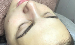 Карбоксітерапія Institute Esthederm Врач-косметолог Ксенія Каменец-Подольский