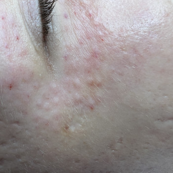 Анастасия Курманенко, Одесса Фото - 22