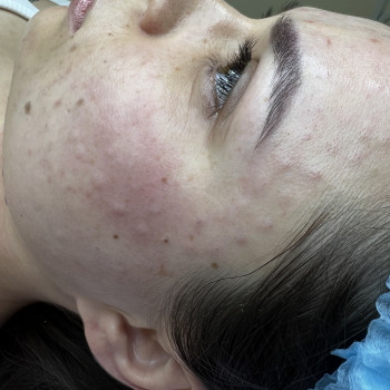 Анастасия Курманенко, Одесса Фото - 24