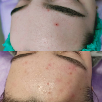 Олена Малипко, Суми Фото - 5