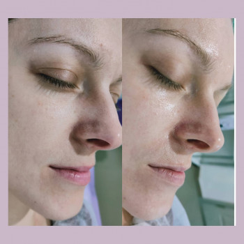 Олена Малипко, Суми Фото - 6