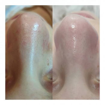 Олена Малипко, Суми Фото - 8