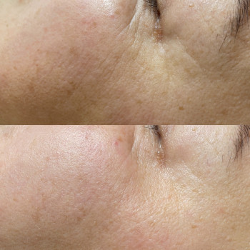 Ірина Москвич, Владимир-Волынский Фото - 7