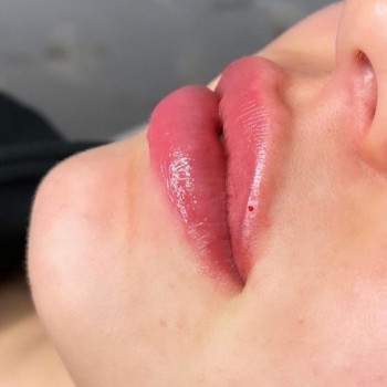 Венеция, Житомир Фото - 28