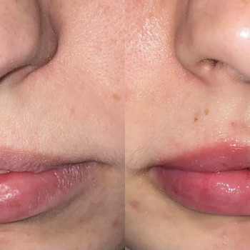 Анна Мишко, Белая Церковь Фото - 5