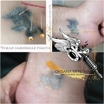 Видалення татуажу брів пікосекундним лазером
                    Мастер перманентного макияжа Оксана Киев