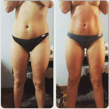 СтарЛазер, Київ Фото - 8