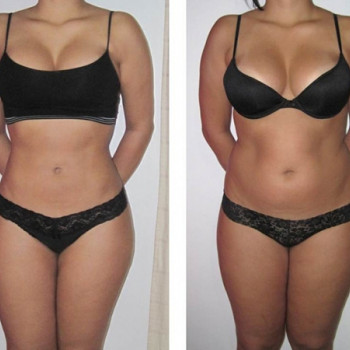 Аппаратный вакуумно-ролликовый массаж
                    Мастер маникюра Лариса Кропивницкий