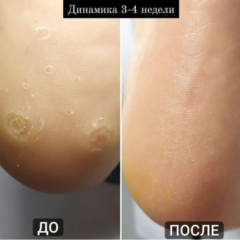 Дмитрий Юрко, Киев Фото - 15