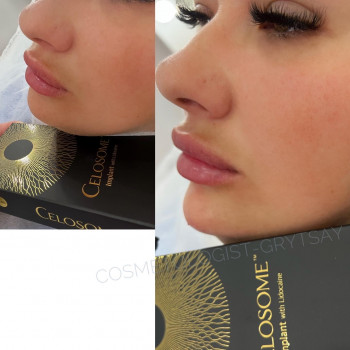 Наталья Грицай, Днепр Фото - 73