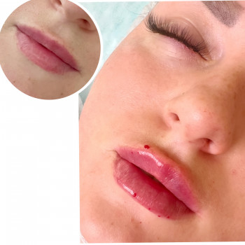 Наталья Грицай, Днепр Фото - 74