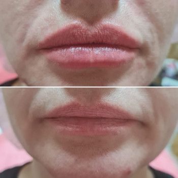 Свежие губки. Естественная форма