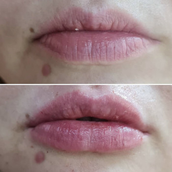 Увлажнение губ