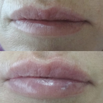 Увлажнение губ, естественная форма