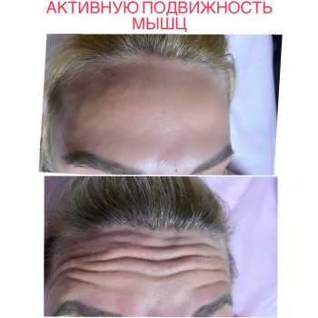 Виктория Турчинова, Полтава Фото - 2