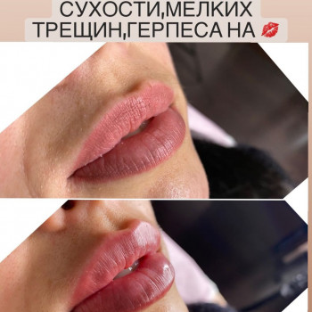 Виктория Турчинова, Полтава Фото - 3