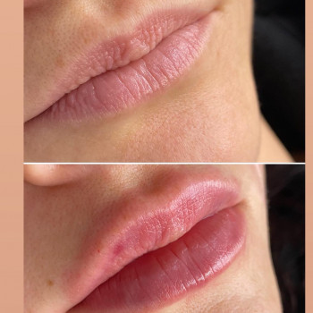 Виктория Турчинова, Полтава Фото - 4