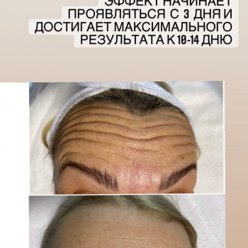 Виктория Турчинова, Полтава Фото - 7