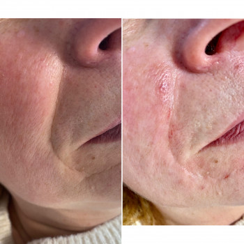 Виктория Турчинова, Полтава Фото - 8