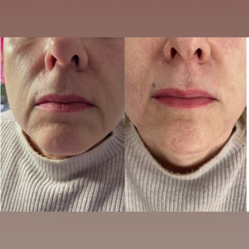 Вікторія Панченко, Київ Фото - 15