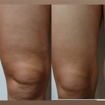 Вікторія Панченко, Київ Фото - 16