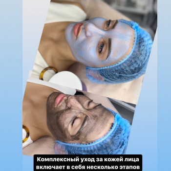 Лазерный Карбоновый пилинг+чёрная маска Zoobadgi