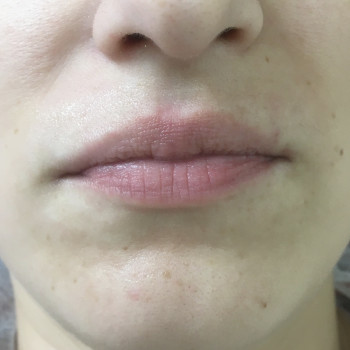 Анастасия Котик, Червоноград Фото - 8