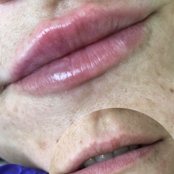 Анастасия Котик, Червоноград Фото - 10