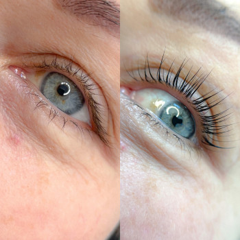 Ламінування вій
                    Бровіст Елена Дніпро