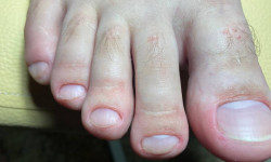 Педикюр (пальчики) Мастер маникюра Анастасія Буча