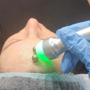 Мікрострумова терапія