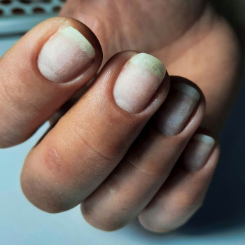 Маникюр
                    Майстер манікюру Анастасия Запоріжжя