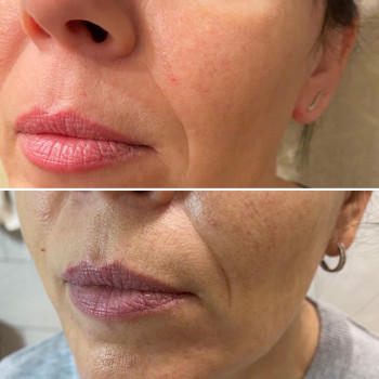 Александра Бевз, Одеса Фото - 5