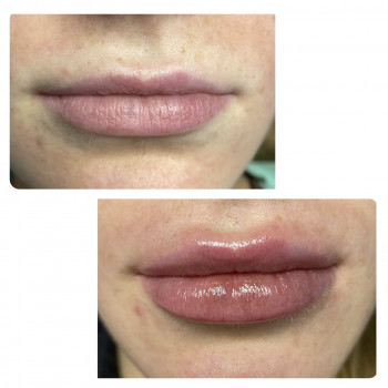 Александра Бевз, Одеса Фото - 6